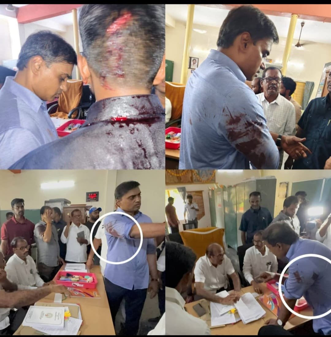 పుంగనూరులో నామినేషన్ల వేళ టీడీపీ–వైసీపీ శ్రేణుల మధ్య తీవ్ర ఘర్షణ ఎంపీ మిథున్‌రెడ్డి కాన్వాయ్‌పై దాడి.. పలువురికి గాయాలు